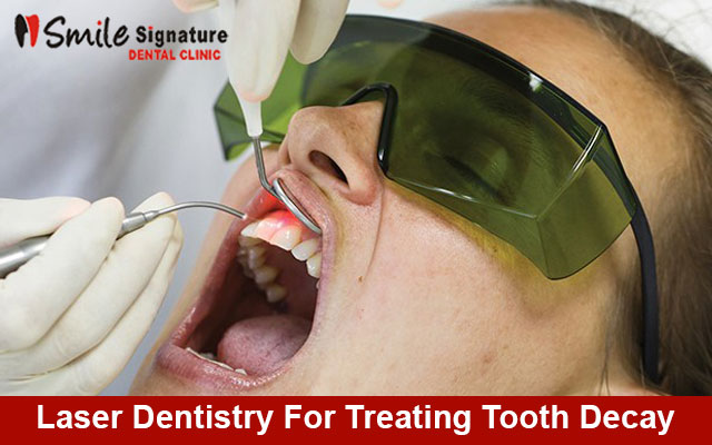 Laser Dentistry For Treating Tooth Decay