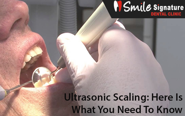 Ultrasonic Scaling