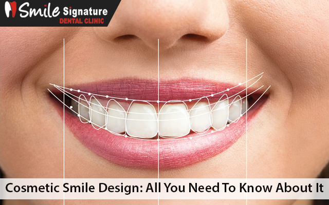 Cosmetic Smile Design: All You Need To Know About It