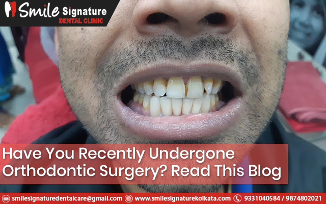 Have You Recently Undergone Orthodontic Surgery Read This Blog