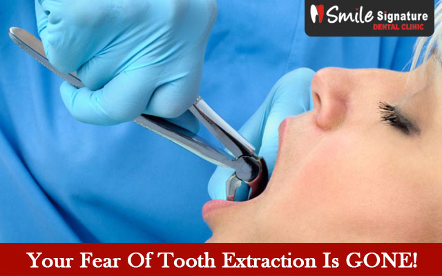 Your Fear Of Tooth Extraction Is GONE!