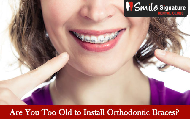 Are You Too Old to Install Orthodontic Braces?
