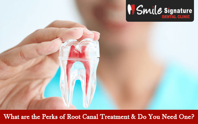 What are the Perks of Root Canal Treatment & Do You Need One?