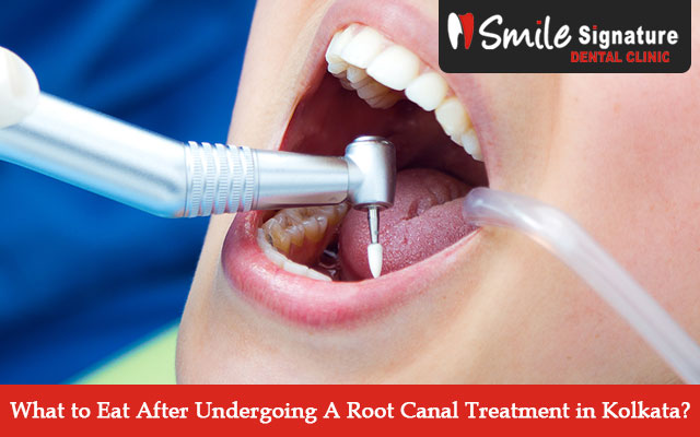 What to Eat After Undergoing A Root Canal Treatment in Kolkata?