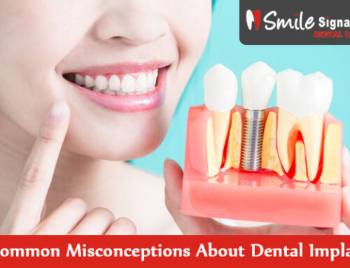 5 Common Misconceptions About Dental Implants